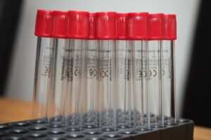 Ricercatrice in laboratorio prepara provette di sangue per l'analisi dei microRNA